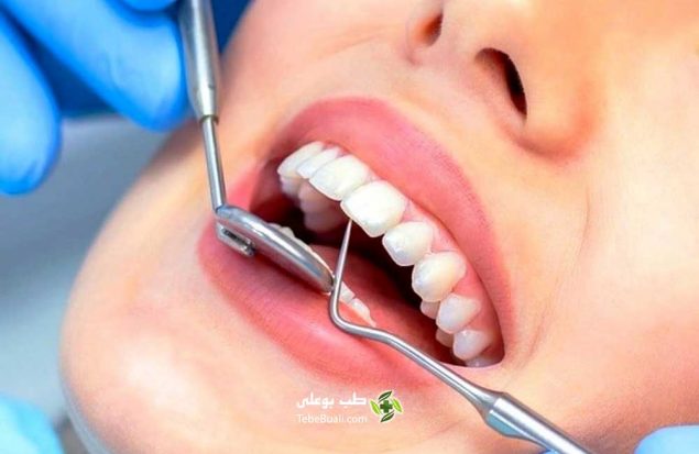 تقویت مینای دندان با طب سنتی